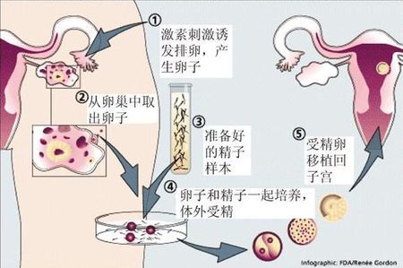 试管供卵公司